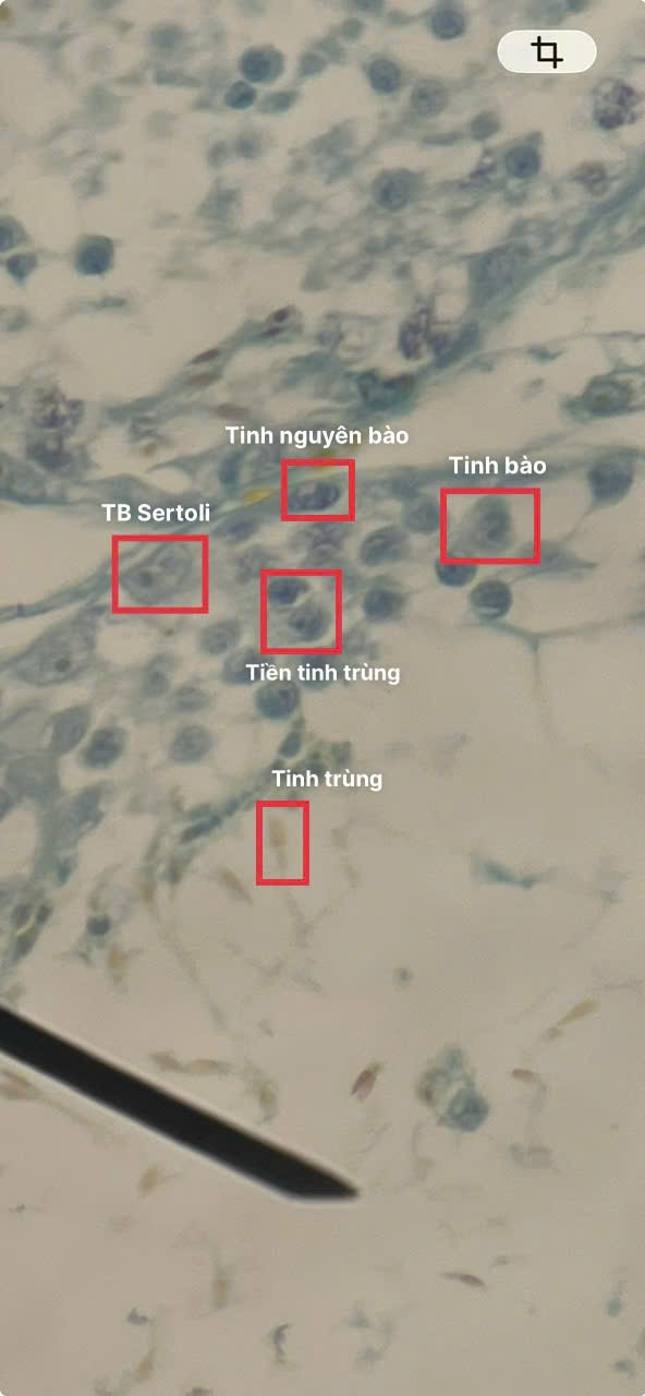 <ol><li><p>Tế bào Sertoli</p></li><li><p>Tinh nguyên bào</p></li><li><p>Tinh bào</p></li><li><p>Tiền tinh trùng</p></li><li><p>Tinh trùng</p></li></ol><p></p>