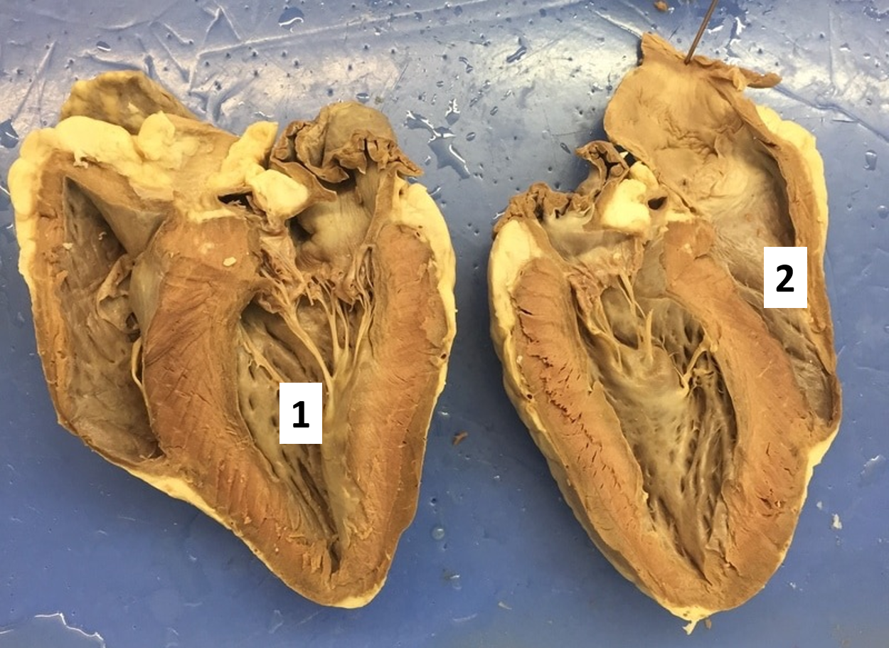 <p>Where will you find oxygenated blood?</p>