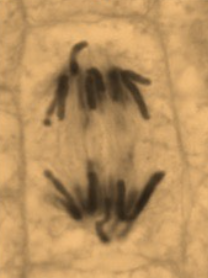 <p>During <strong> ________</strong>, the main visual event is the <strong>separation and movement of chromosomes</strong> to opposite sides of the cell.</p>