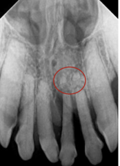 <p>What is circled?</p>