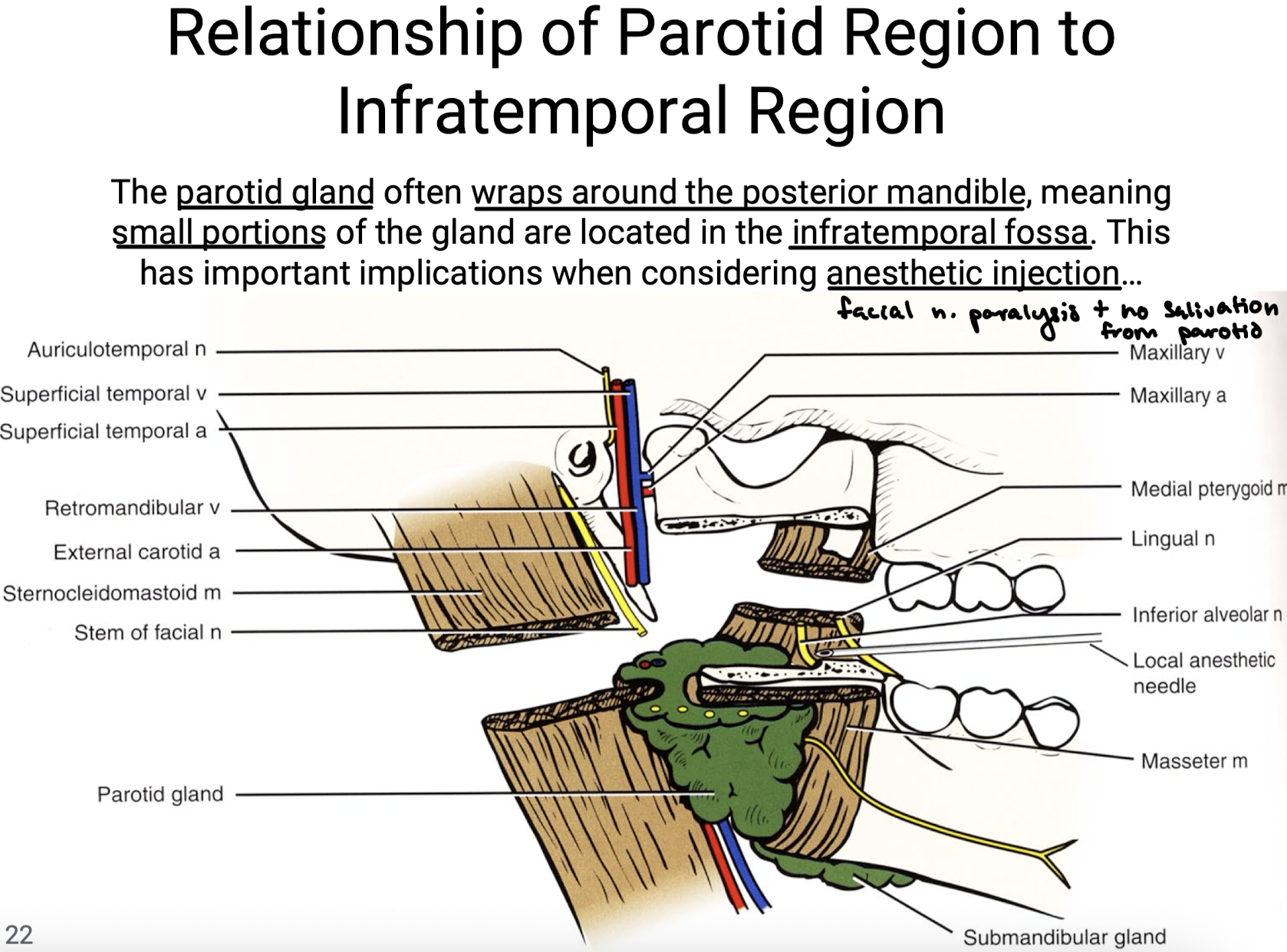 <p>The parotid gland often wraps around the posterior mandible, meaning small portions of the gland are located in the infratemporal fossa. This has important implications when considering anesthetic injection because accidental injection of the parotid would lead to facial n. paralysis and no salivation from parotid.</p>