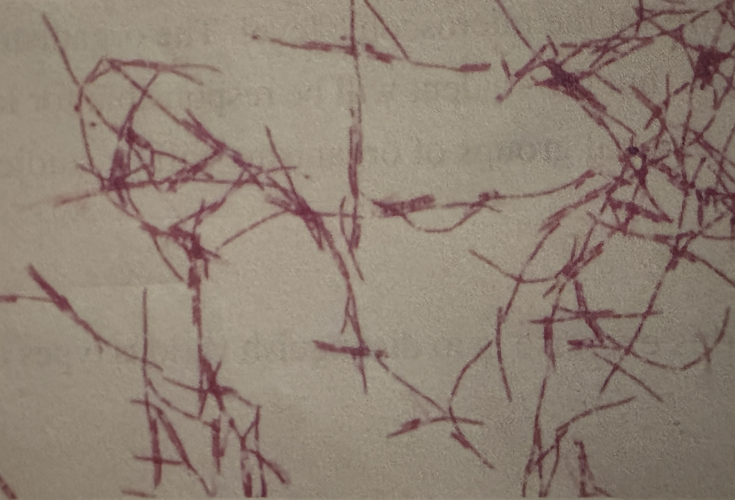 <p>Bacillus anthracis </p>