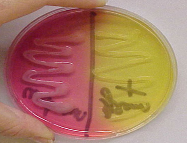 <p>Selectief en electief</p><ul><li><p>Selectieve stoffen: NaCl (hoge concentratie, bvb. 7,5% NaCl) → remt de groei van de meeste bacteriën, maar halotolerante bacteriën kunnen wel groeien</p></li><li><p>Groei van: Staphylococcen </p></li><li><p>Electieve stoffen: mannitol en fenolrood (pH-indicator) → mannitolnegatieve kolonies kleuren wit/kleurloos (rode bodem), mannitolpositieve kolonies kleuren geel (gele bodem) (zuurproductie en lagere pH zorgen voor kleurverandering) → S. aureus = mannitolpositief en S. epidermidis = mannitolnegatief</p></li></ul><p><strong>37°C</strong></p>
