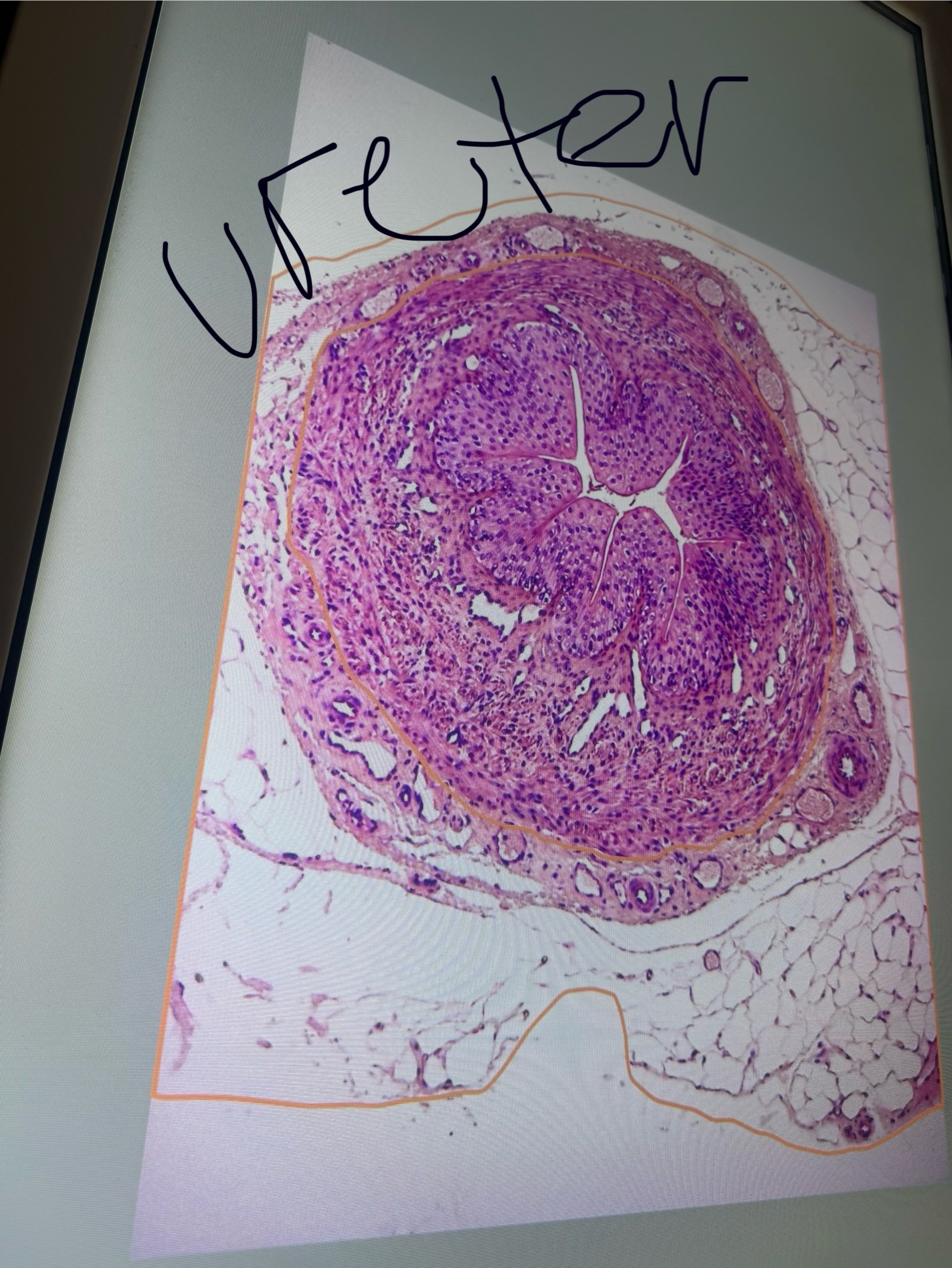 <p>what kind of ET is the ureter?</p>