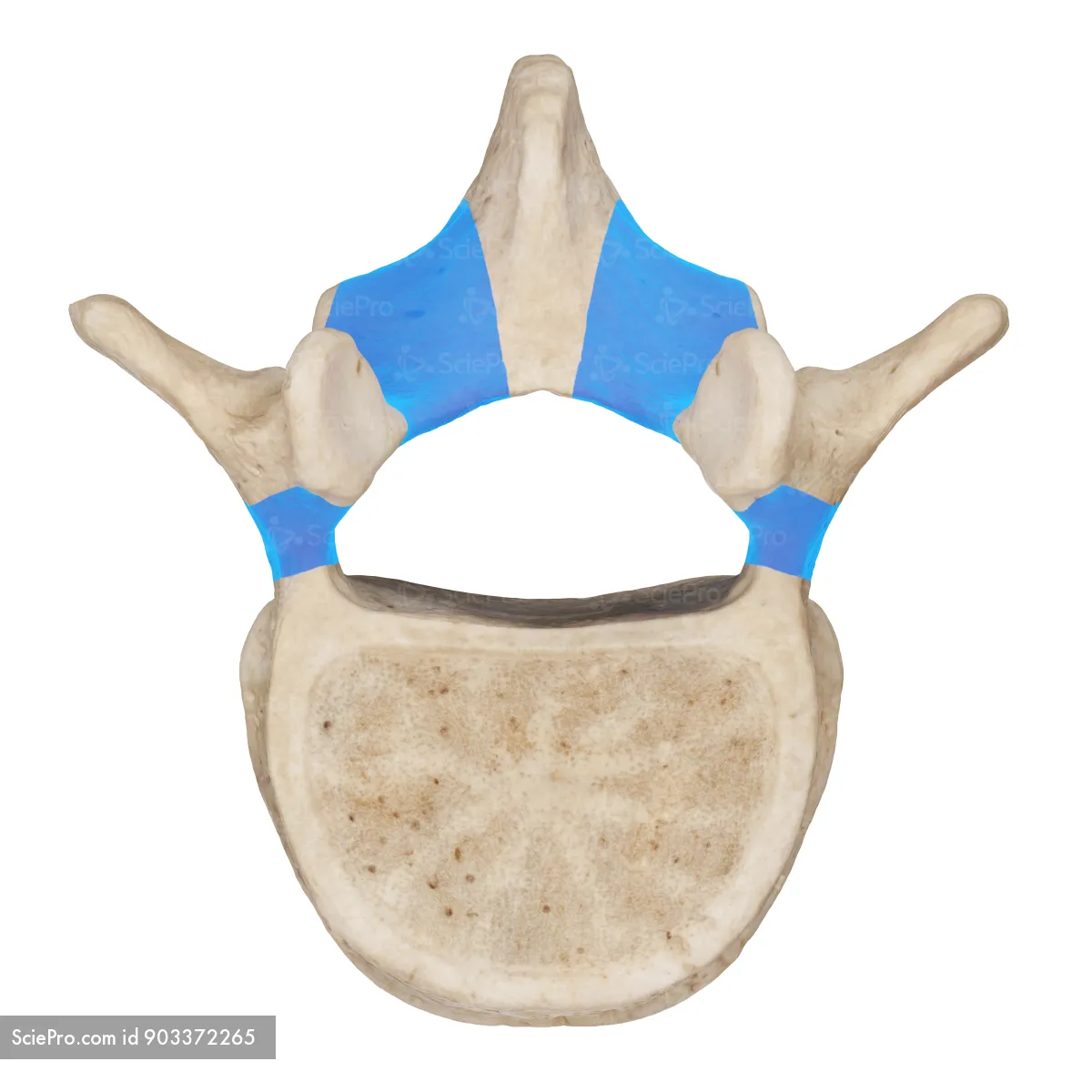 <p>the posterior, arch-shaped bony structure of a vertebra that encloses and protects the spinal cord</p>