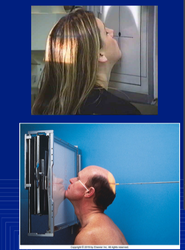 <p>collim of WATER NASAL BONES</p>