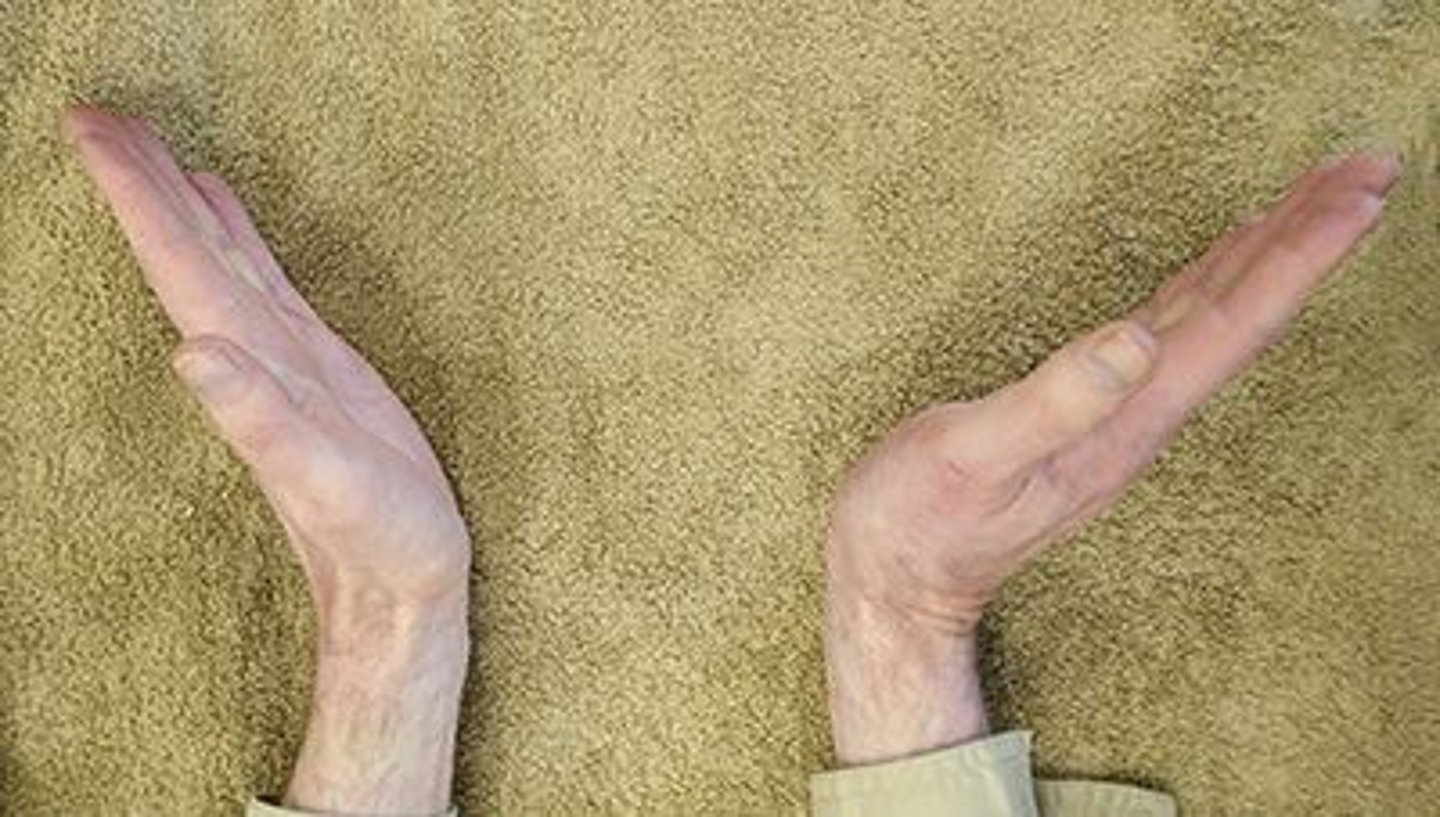<p>4,4</p><p>1. The power grip produces the greatest amount of force for hand grip. The power grip of the hand requires range of motion of slight extension and ulnar deviation. The dorsal mobilization is used for improving flexion, while the ulnar mobilization is used for improving radial deviation. Therefore, both of these mobilizations would not help improve the motions required for the power grip.</p><p>2. The power grip produces the greatest amount of force for hand grip. The power grip of the hand requires range of motion of slight extension and ulnar deviation. The dorsal mobilization would improve flexion, while the radial mobilization would improve ulnar deviation. Therefore, these would not be the most effective mobilization directions.</p><p>3. The power grip produces the greatest amount of force for hand grip. The power grip of the hand requires range of motion of slight extension and ulnar deviation. Although mobilization in a volar (palmar) direction would improve extension, the ulnar glide would increase radial deviation, not ulnar deviation.</p><p>4. The power grip produces the greatest amount of force for hand grip. The power grip of the hand requires range of motion of slight extension and ulnar deviation. While stabilizing the distal radius and ulna, mobilizing the proximal carpal rows in a volar (palmar) direction will increase extension, while a radial mobilization will increase ulnar deviation (Dutton). Therefore, a volar (palmar) glide followed by a radial glide would improve both extension and ulnar deviation, resulting in an improved power grip.</p>