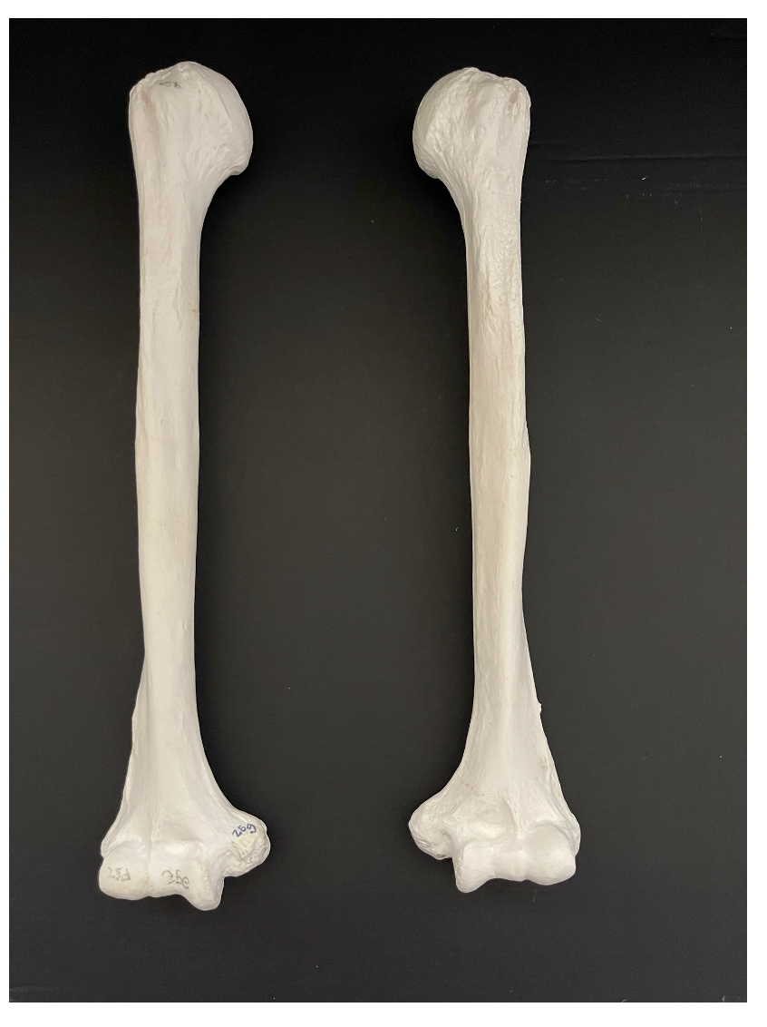<p>Identify the name of the bone that is being depicted in the image.</p>