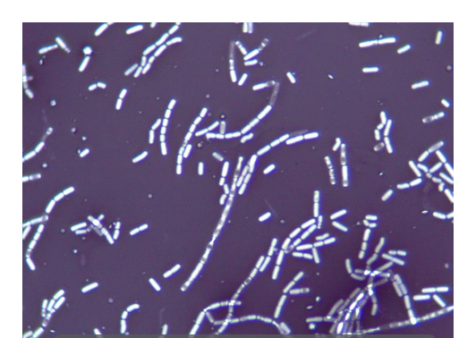 <p>What type of stain is this?</p>