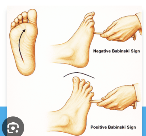 <p>Use a cutaneous stimulus along the lateral plantar foot, then across the metatarsal heads toward the medial side</p>
