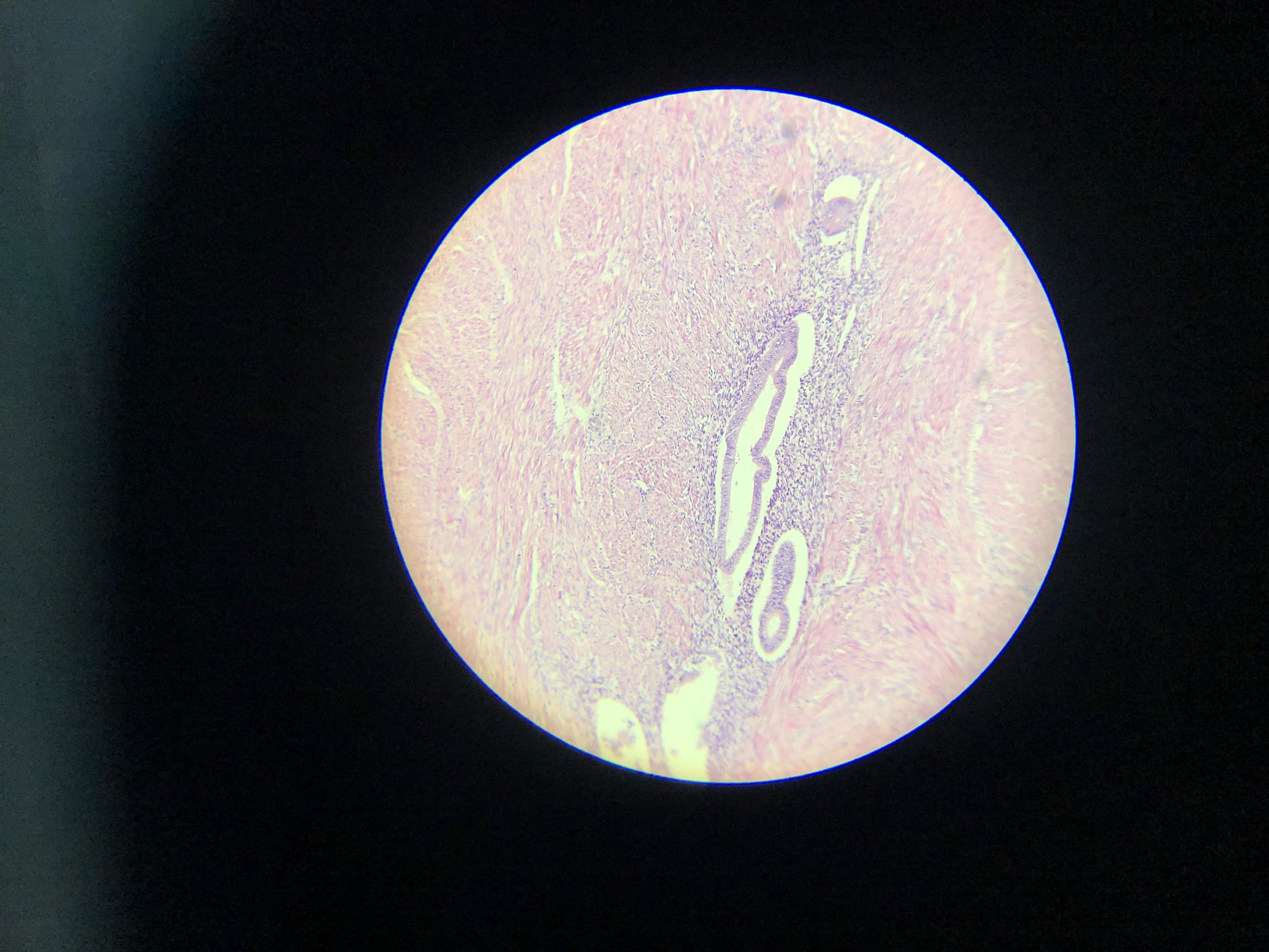 <p>What is the diagnosis?</p>