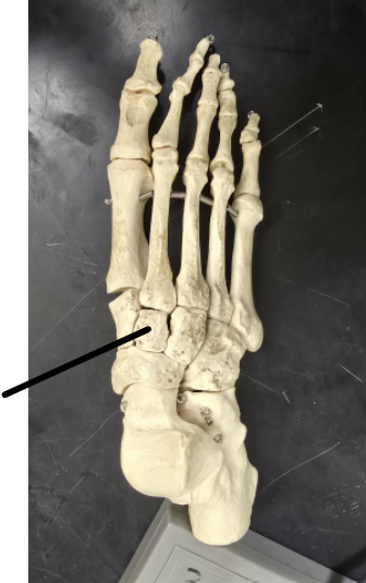 <p>Name Tarsal Bone</p>