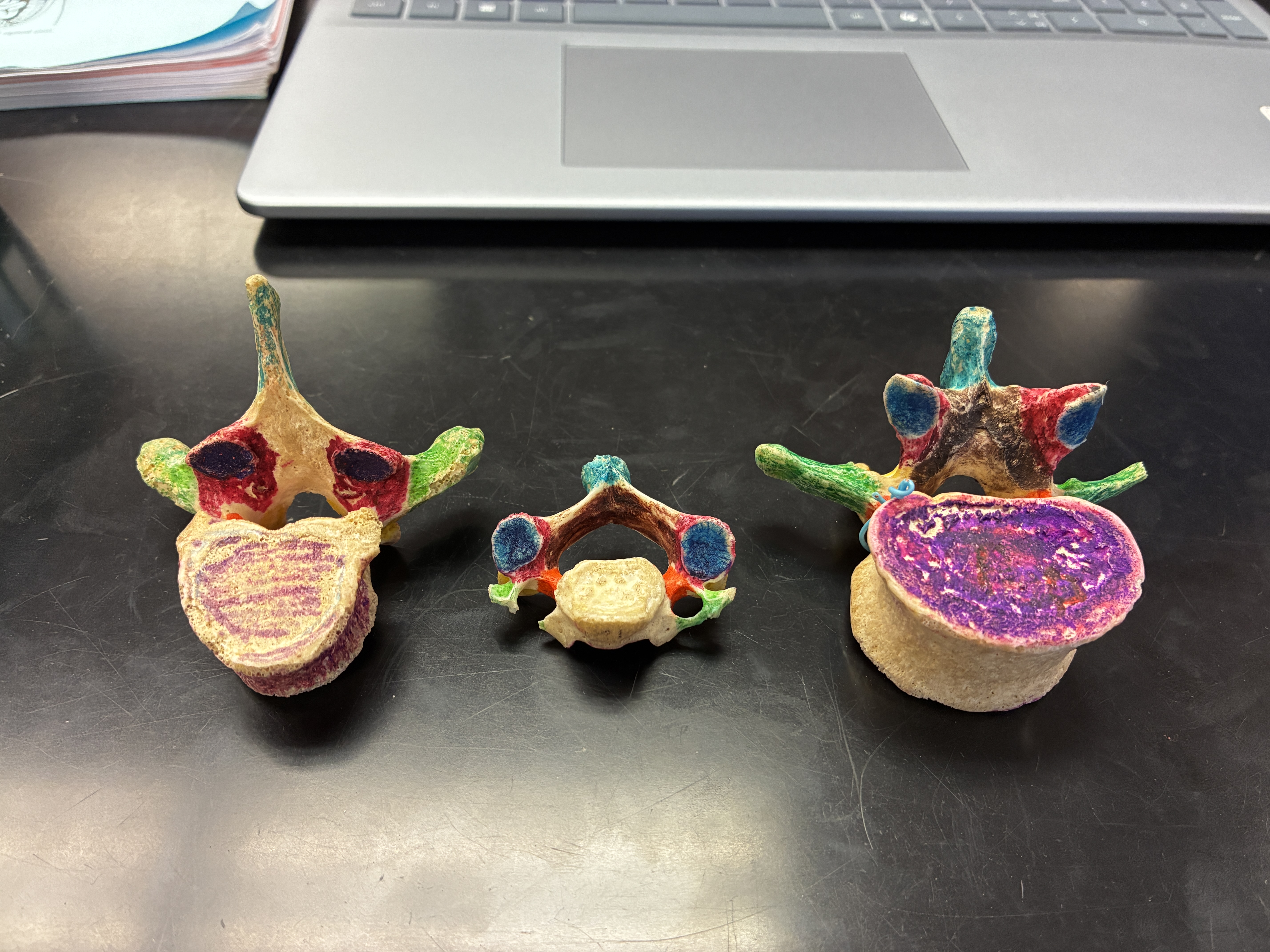 <p>What’s the name of the Dark Pink parts on the 3 models?</p>