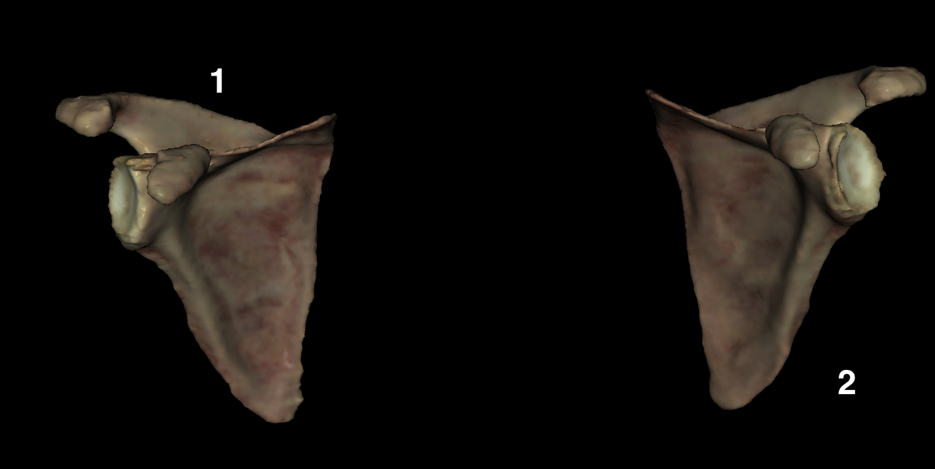 <p>Which is the right scapula?</p>