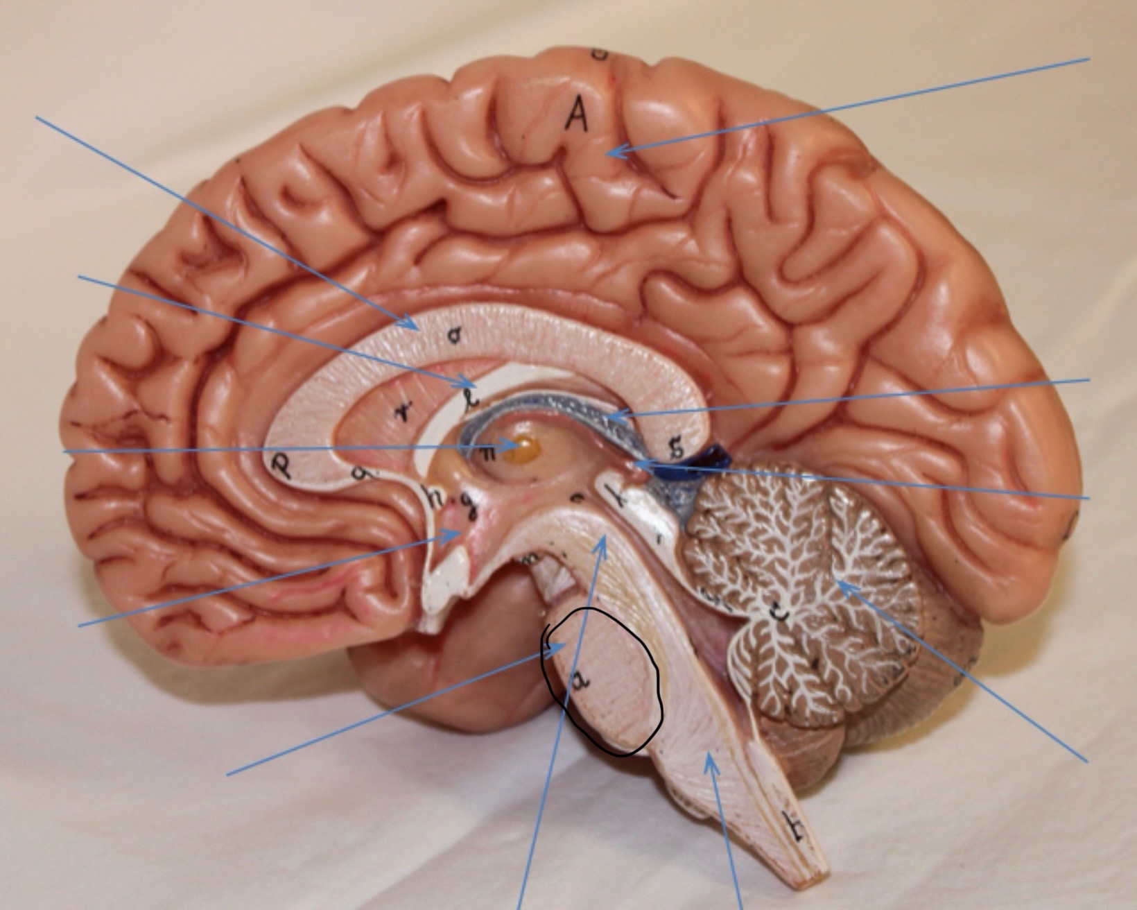 <p>Identify the circled area?</p>
