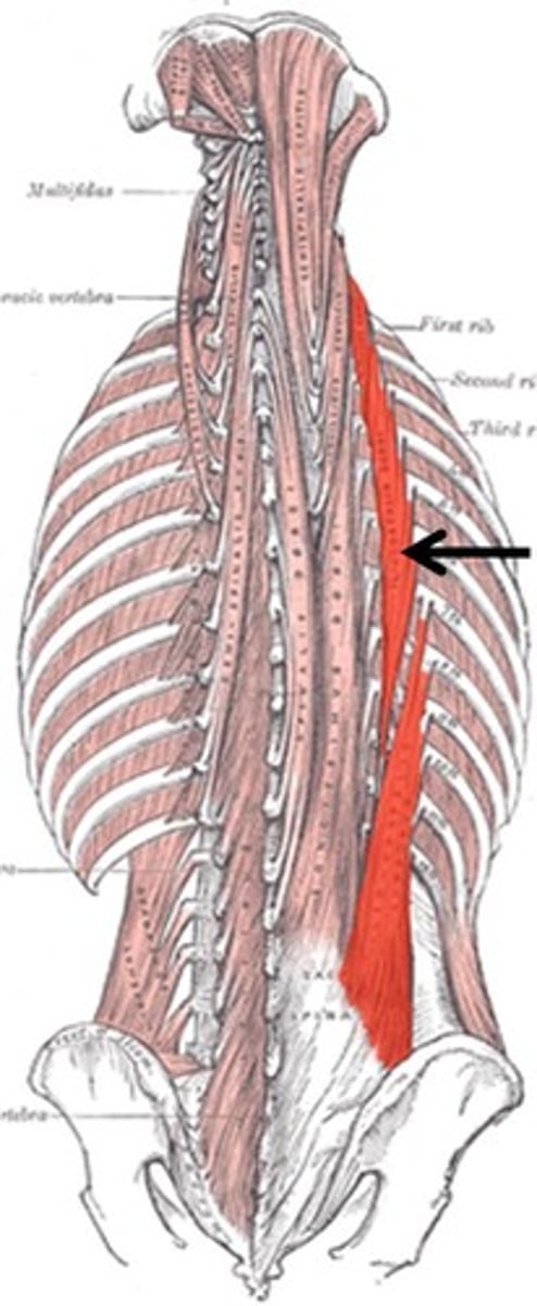 <p>Erector spinae group</p><p>Extends trunk; Laterally flex trunk</p><p>O: pelvis and ribs</p><p>I: ribs and vertebrae</p>