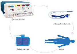 <p>equipment, used lower voltage so less energy is required; the surgeon bipolar forceps that connects to the electrosurgical generator</p>