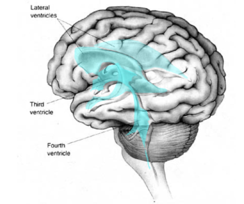 <p>Cerebrospinal fluid (CSF) is inside the brain (ventricles) and surrounds the brain and spinal cord. </p><p>CSF is produced in the choroid plexus in the lateral, third, and fourth ventricles. CSF is reabsorbed by arachnoid granulations into the dural venous sinuses. Minor pathways include spinal nerve roots and lymphatics. </p><ul><li><p>if not drained properly, a catheter is inserted. This drains CSF from the lateral ventricle into the peritoneal cavity to treat hydrocephalus. </p></li></ul><p></p>