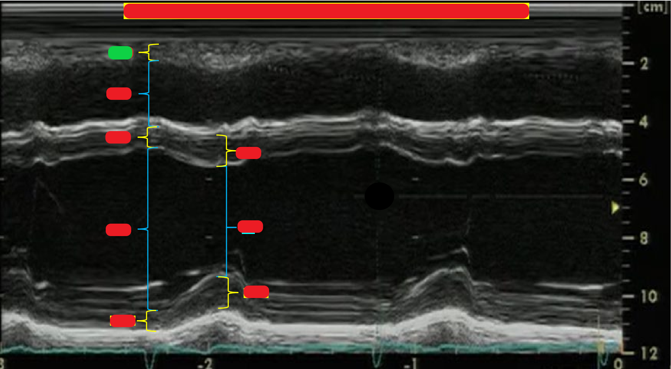 <p>What is highlighted in green?</p>