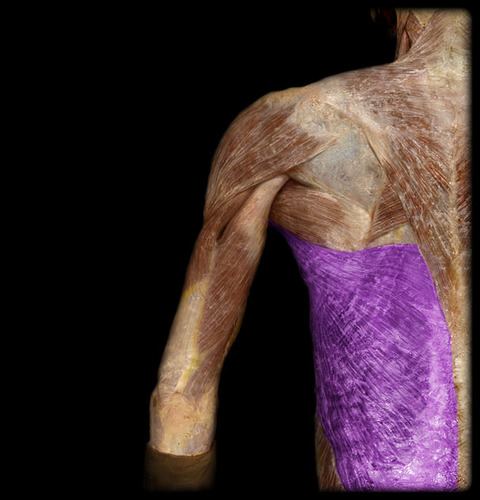<p>What is this superficial muscle (highlighted)?</p>