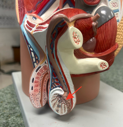 <p>convoluted tube located on the posterior, superior portion of the testis that both stores sperm for continued maturation and transports sperm to the ductus deferens</p>