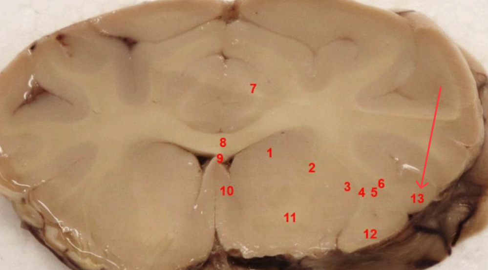 <p>what cortex is this</p>