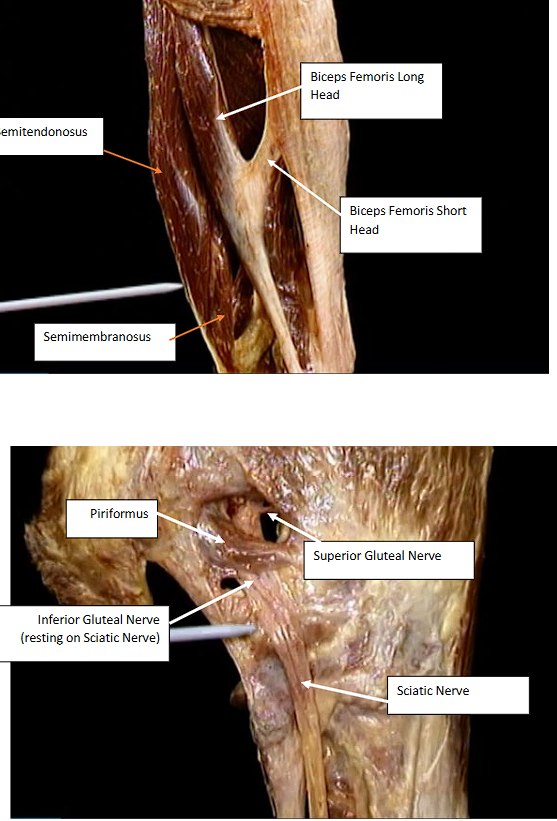 <p>more images for posterior thigh and gluteal region </p>