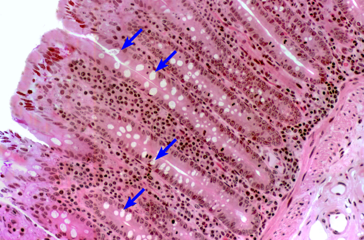 <p>Colon</p><p><strong>NOTICE: THE LARGE NUMBER OF GOBLET CELLS WHICH ARE LIGHTER IN COLOR DUE TO THE WATER CONTENT NEEDED TO PROTECT FROM SOLID WASTE, THE MUCOSA ALSO HAS MORE UNIFORM RIDGES</strong></p>