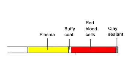 <ol><li><p>plasma </p></li><li><p>buffy coat </p></li><li><p>RBC </p></li></ol><p></p>