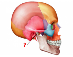 <p>Identify this structure.</p>