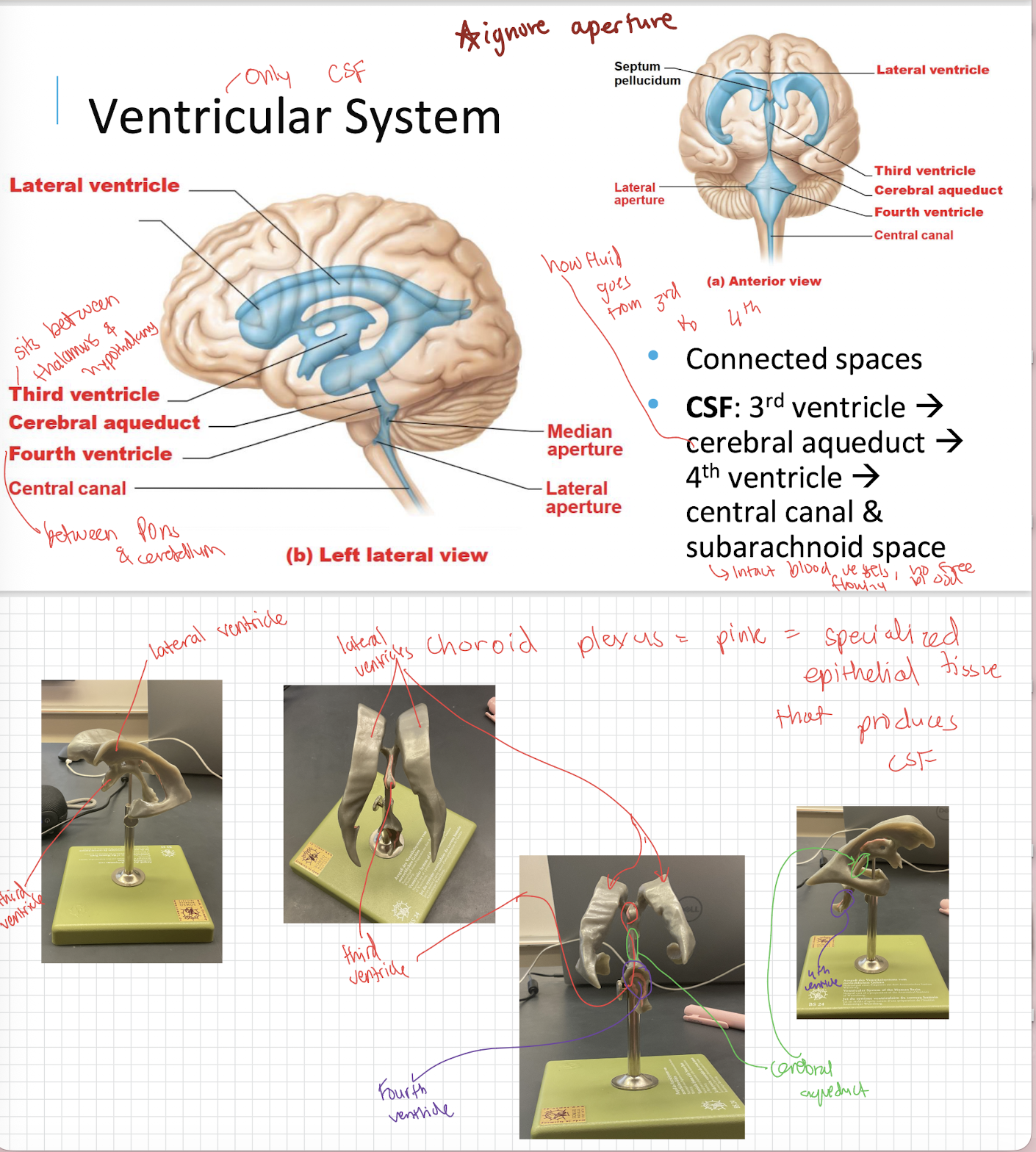 <p>A narrow channel connecting the third ventricle to the fourth ventricle.</p>