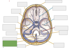 <p>This is the</p>