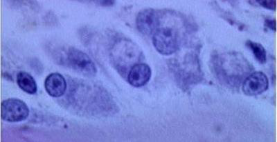 <p>What kind of chromatin is pictured in these nuclei</p>