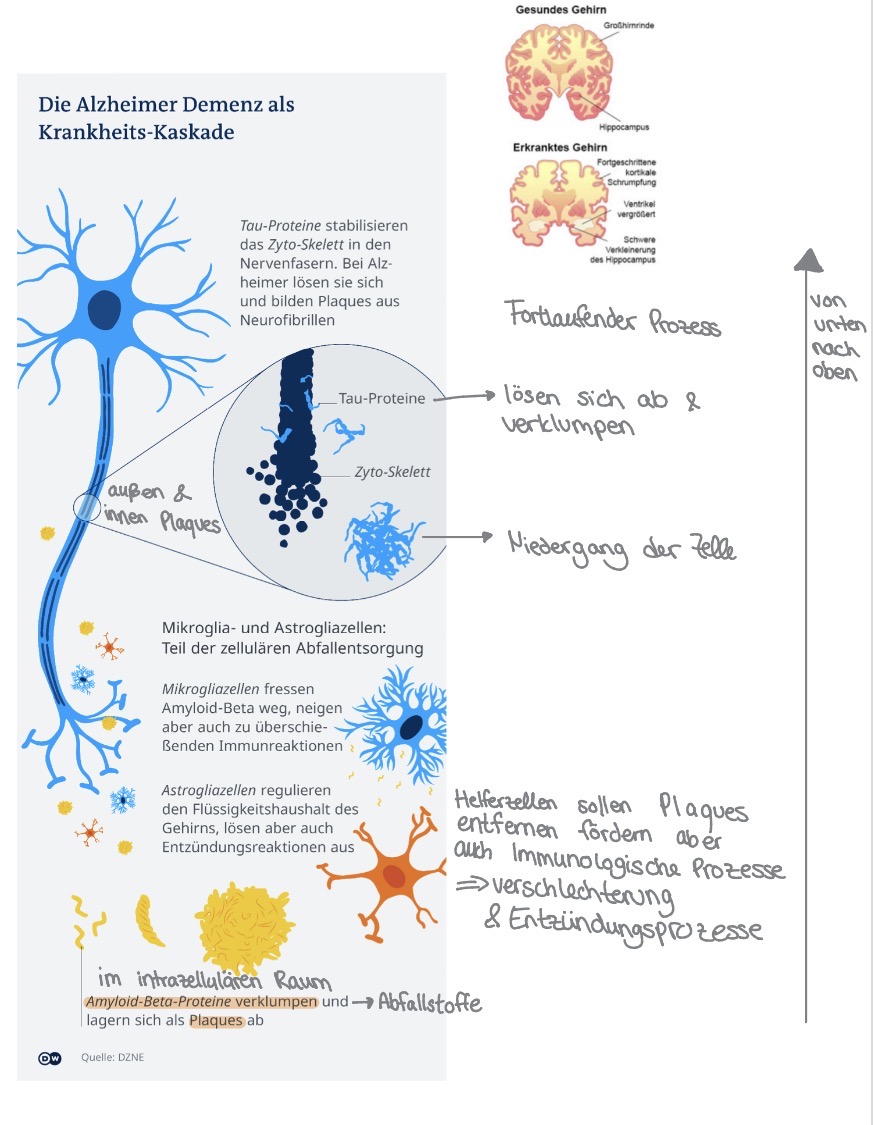 <p>Charakteristik </p><ul><li><p>Beeinträchtigung mehrerer kognitiver Fähigkeiten, besonders im Vordergrund: anterograde amnestische Symptomatik (neue Informationen nicht gespeichert & schlechtere Orientierung) </p></li><li><p>Erworben </p></li><li><p>persisting und fortschreitend → kann nicht aufgehalten werden </p></li><li><p>Keine Bewusstseinsstörung </p></li><li><p>Beeinträchtigung des Alltagslebens </p></li></ul><p></p><p>Pathologie </p><ul><li><p>komplexes, multifaktorielles Krankheitsgeschehen; Fokus liegt aber auf krankhaften Veränderungen in den Zellen und dem Zellstoffwechsel </p></li></ul><p></p>