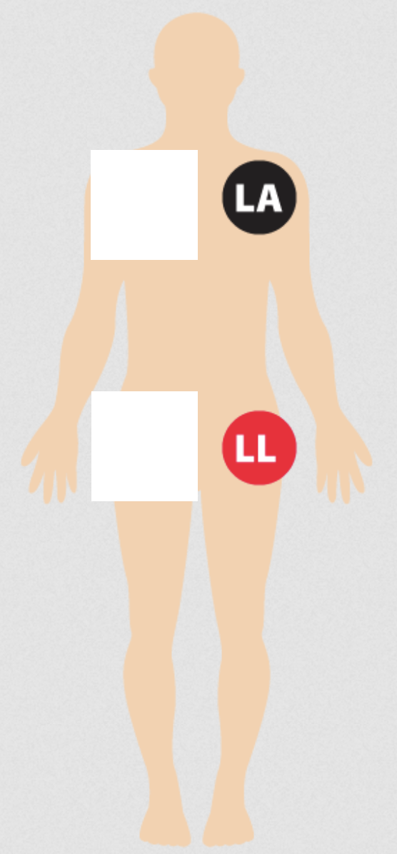 <p>left limb lead placement - for all EKGs</p>