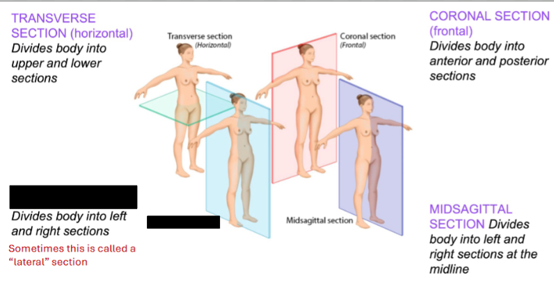 <p>Identify the anatomical plane/section shown.</p>