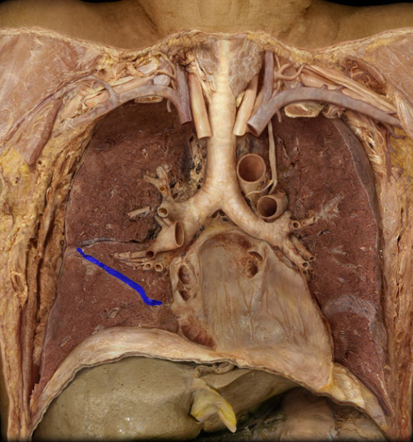 <p>Right on this side &amp; Left on answer side</p>