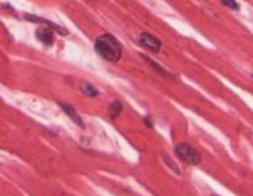<p>cardiac muscle</p>