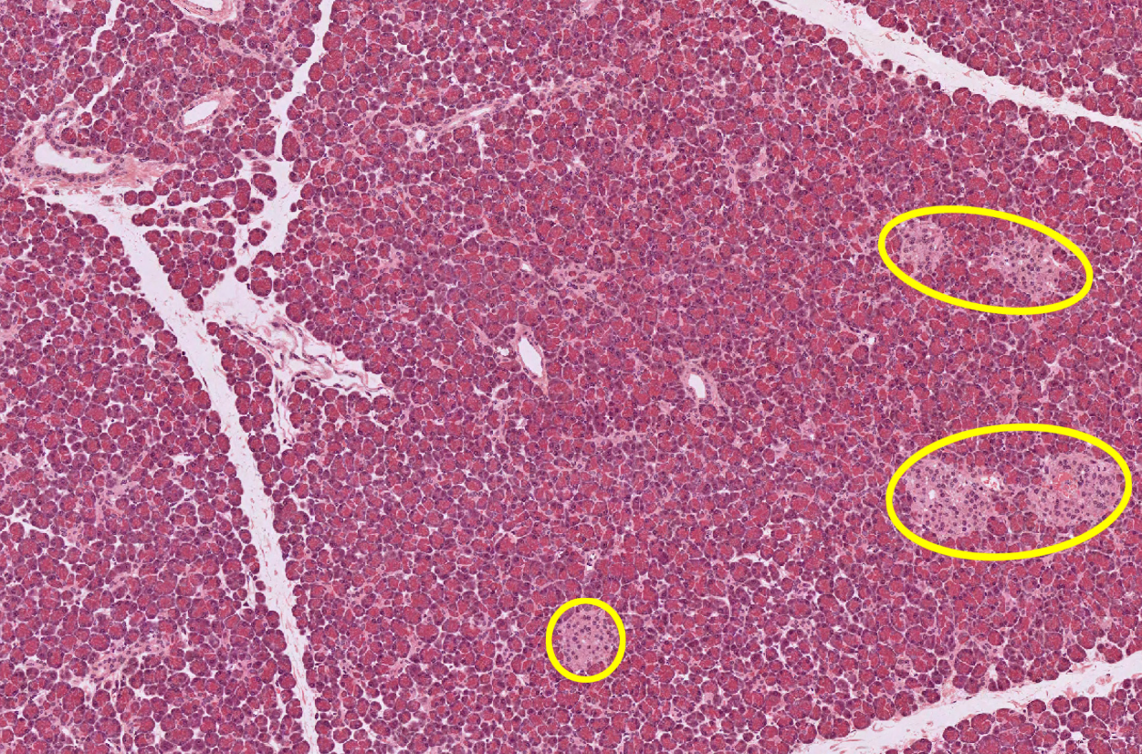 <p>Pancreas</p><p><strong>NOTICE: ISLET OF LANGERHANS WHICH ARE WHERE ENDOCRINE CELLS ALL PACKED TOGETHER</strong></p>