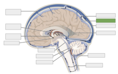 <p>This is the</p>