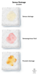 <p>Serous (helps w/ healing)</p>