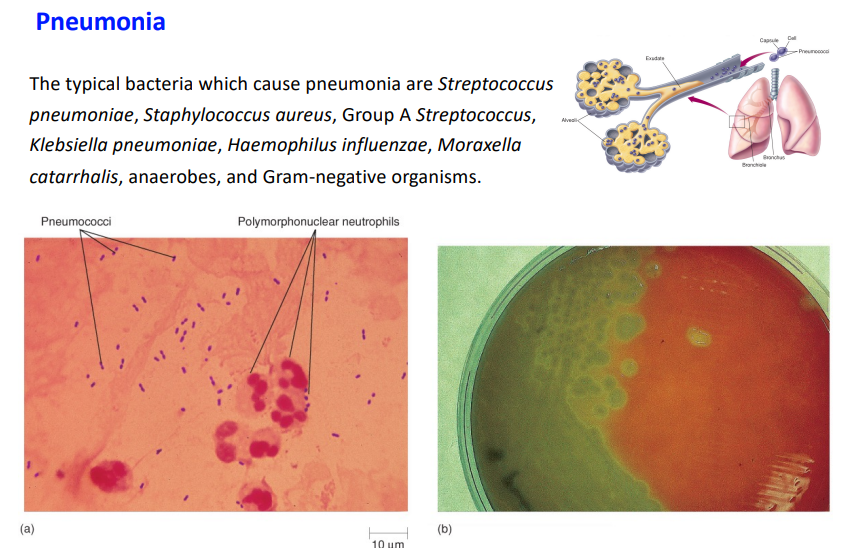 <p>3 examples of bacteria which cause penumonia</p>