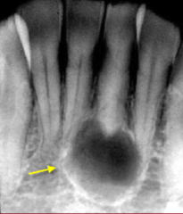 <p>Describe the periphery/borders of the lesion:</p>