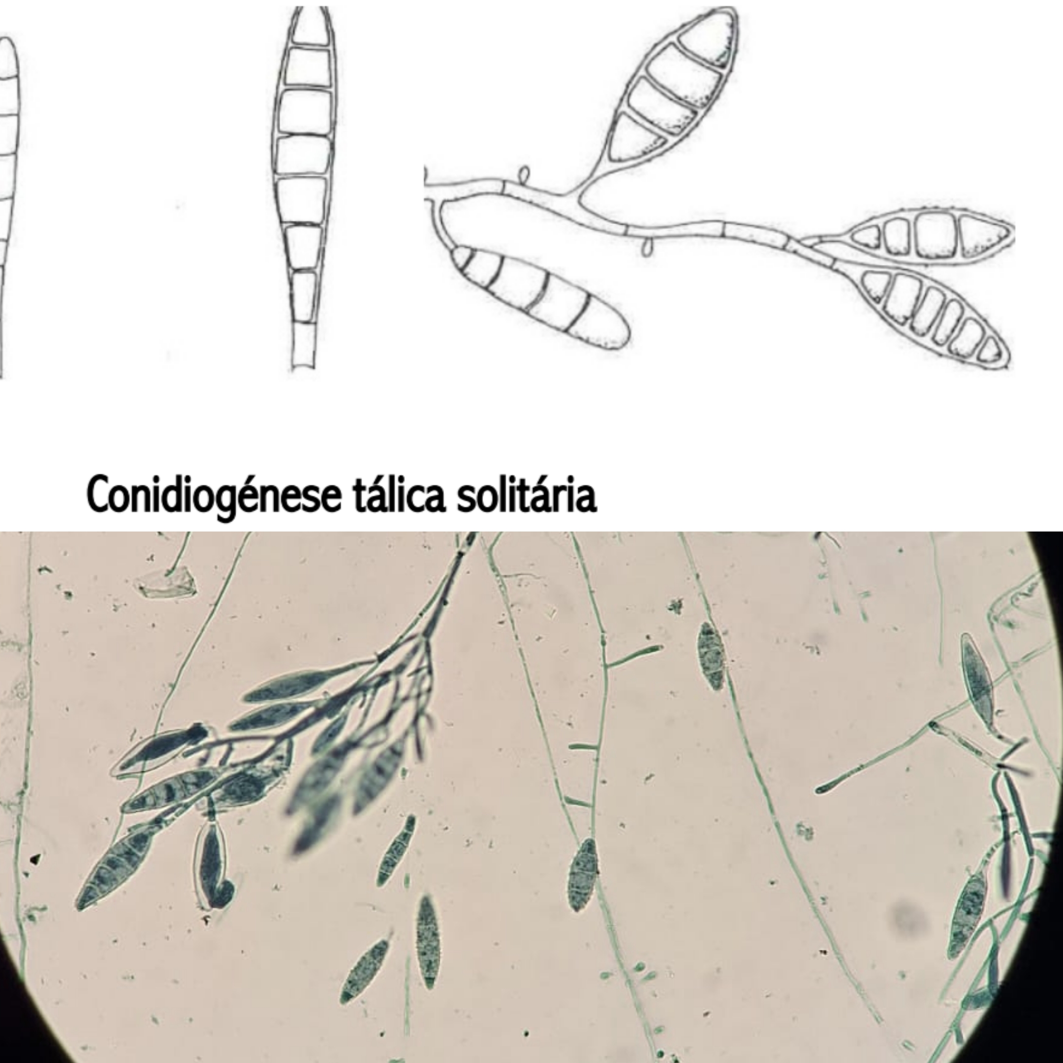 <p>Indica:</p><p class="has-focus">Se é fungo filamentoso inferior ou superior</p><p class="has-focus">O gênero do fungo</p><p class="has-focus">Características que o distingue</p>