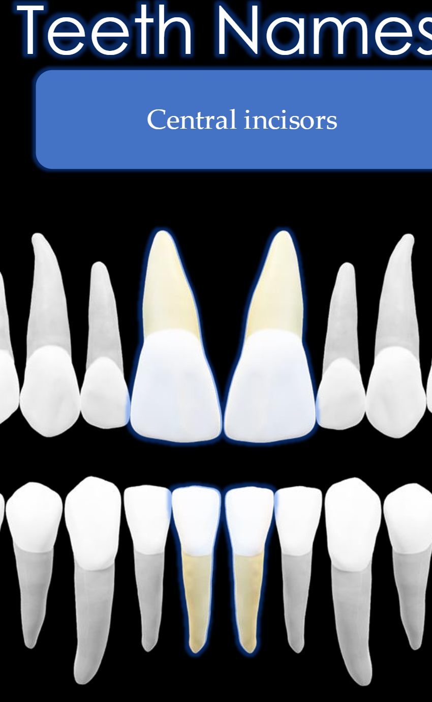 <p>Teeth #: 8,9,24,25</p>