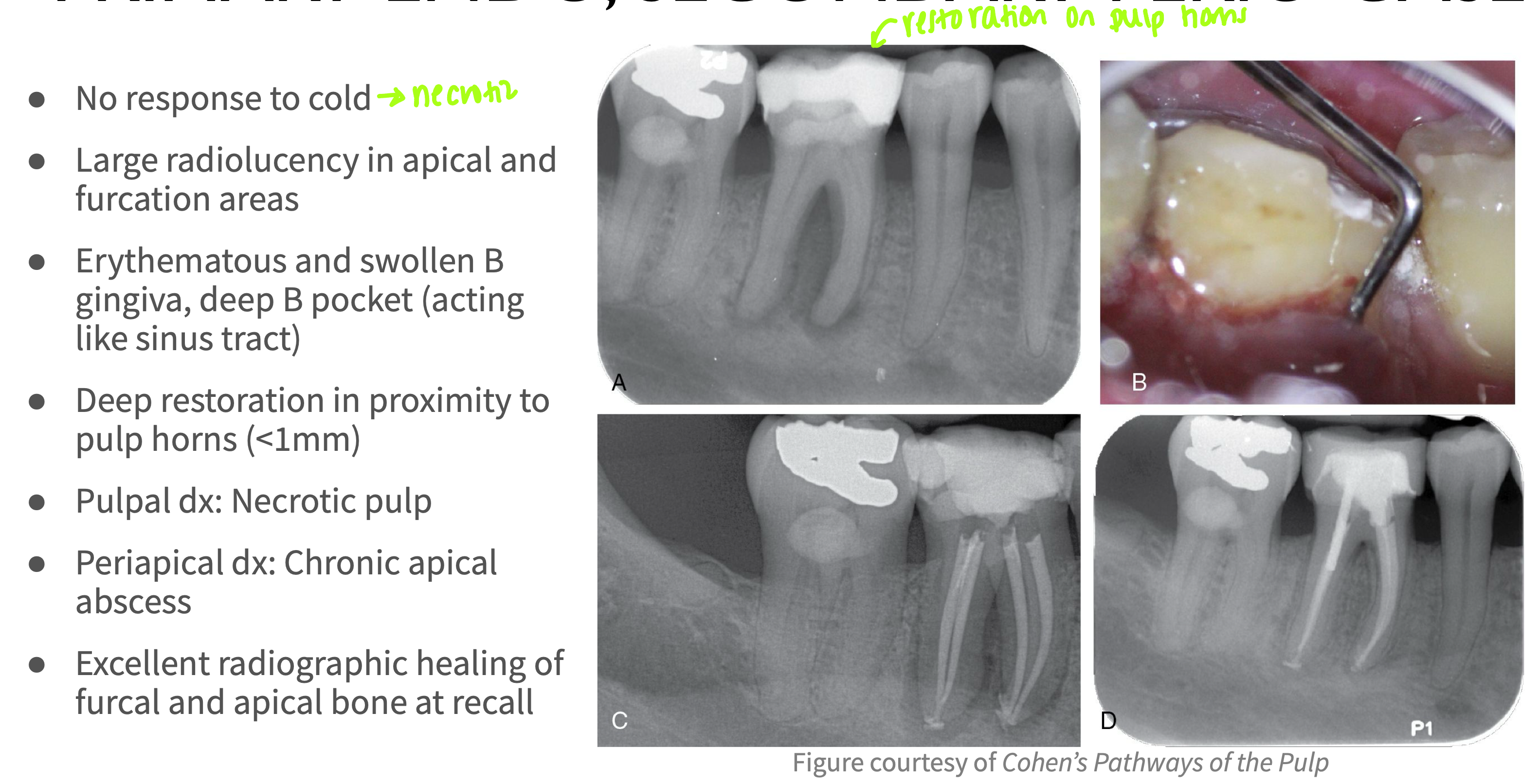 <p>What type of lesion?</p>