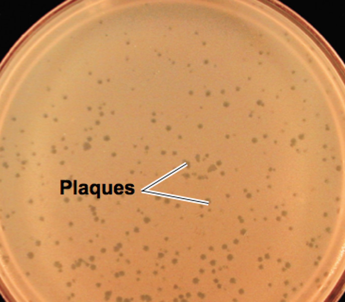 <p>TRANSLATION: выращивание уникальной бактерии</p><p>DEFINITION: the process of growing a single special type of microbe in a lab</p><p>EXAMPLE: Mechnikov succeeded in ........................ that could fight diseases in the human gut. Мечникову удалось ВЫРАСТИТЬ УНИКАЛЬНУЮ БАКТЕРИЮ, которая могла бороться с болезнями в кишечнике человека.</p>
