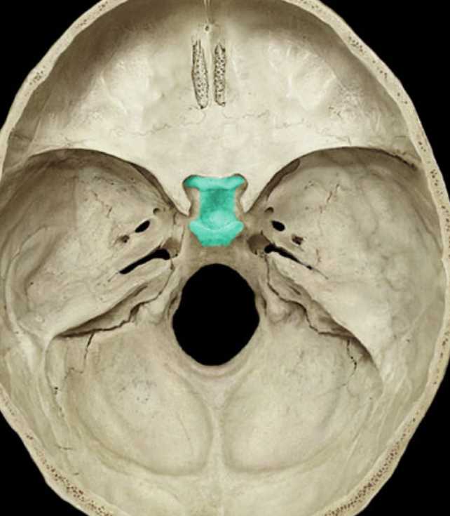 term image