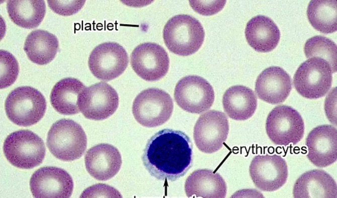<p><span><span>small white blood cells</span></span></p><p class="s13"><span><span>○About the same size as the surrounding RBCs</span></span></p><p class="s13"><span><span>○Can be B lymphocytes or T lymphocytes but we can’t tell from looking</span></span></p><p class="s13"><span><span>○No granules, Nucleus takes up nearly the entire cell</span></span></p>