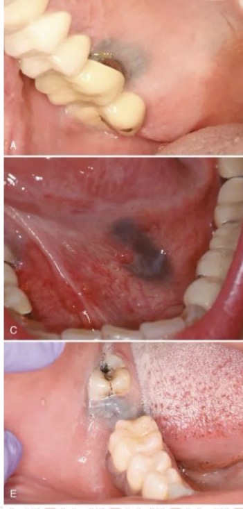 <p>CHẨN ĐOÁN .?</p>